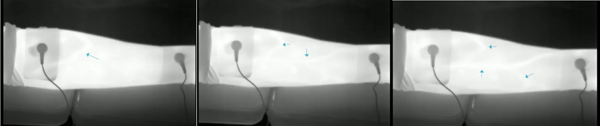 一張含有 X 光影像, 螢幕擷取畫面, 黑色, 黑與白 的圖片
AI 產生的內容可能不正確。